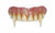 Hammer Horror Dracula Fangs Adult Costume Accessory